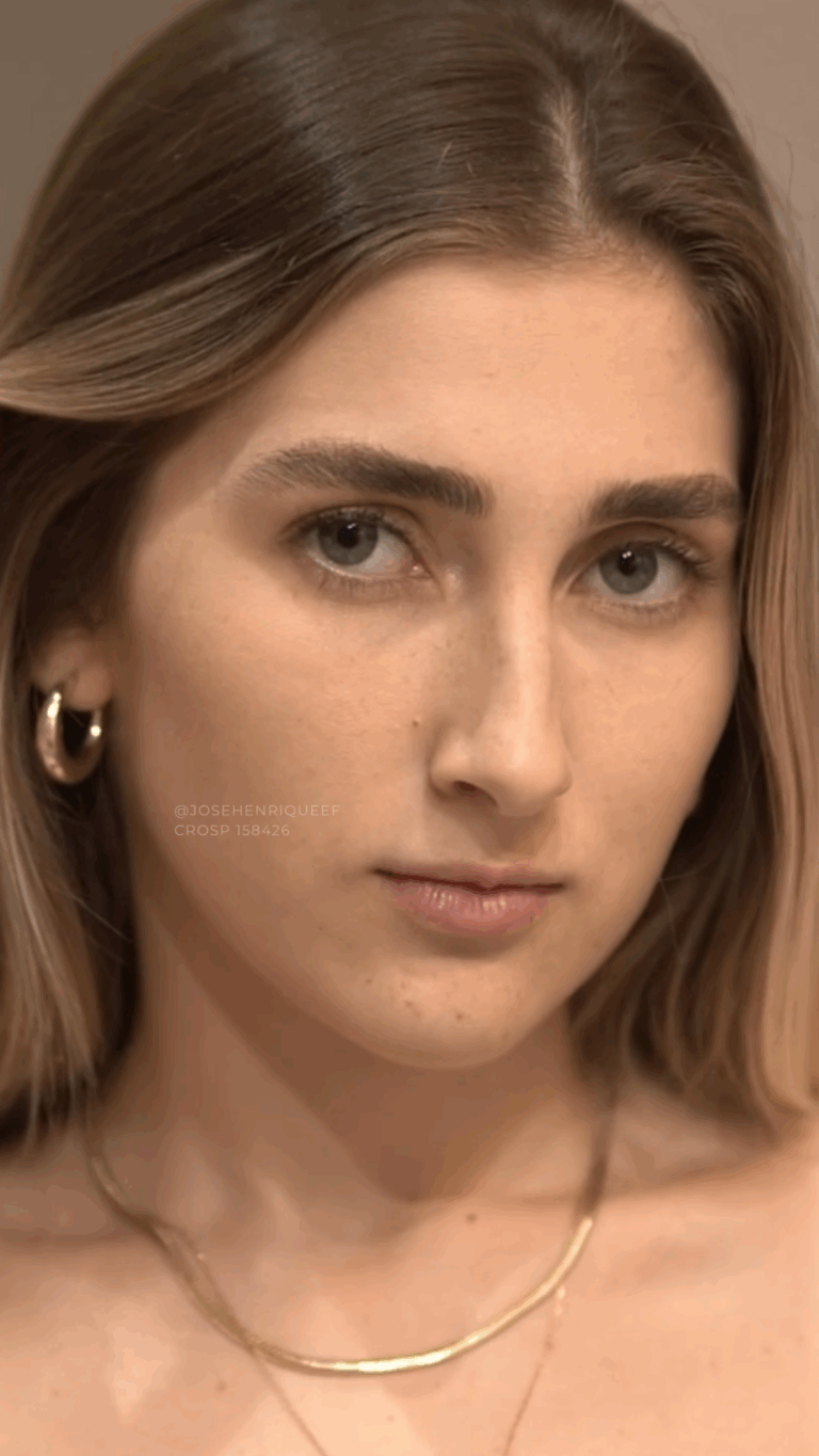 Antes — Natural Beauty, paciente Estéfany Corteleti